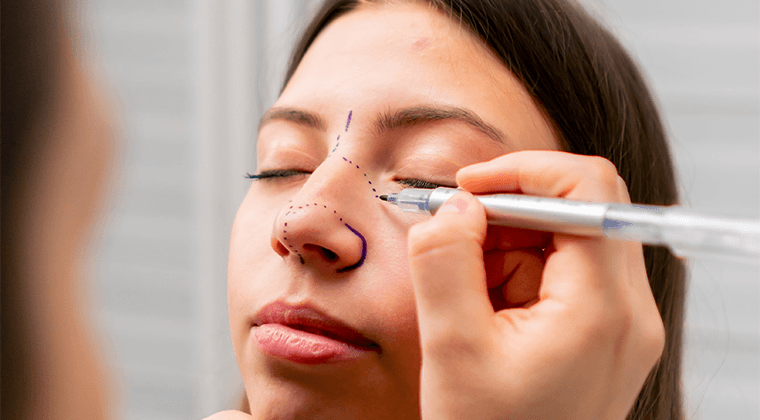Rinoplastia estética
